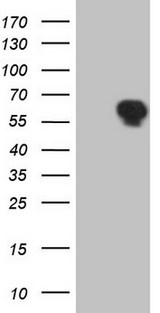 TRIB1 Antibody - HEK293T cells were transfected with the pCMV6-ENTRY control (Left lane) or pCMV6-ENTRY TRIB1 (Right lane) cDNA for 48 hrs and lysed. Equivalent amounts of cell lysates (5 ug per lane) were separated by SDS-PAGE and immunoblotted with anti-TRIB1.