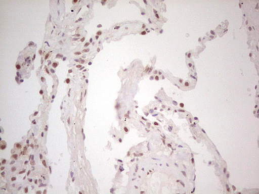 TRIB1 Antibody - Immunohistochemical staining of paraffin-embedded Human lung tissue within the normal limits using anti-TRIB1 mouse monoclonal antibody. (Heat-induced epitope retrieval by 1 mM EDTA in 10mM Tris, pH8.5, 120C for 3min,