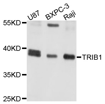 TRIB1 Antibody - Western blot analysis of extracts of various cell lines, using TRIB1 antibody at 1:1000 dilution. The secondary antibody used was an HRP Goat Anti-Rabbit IgG (H+L) at 1:10000 dilution. Lysates were loaded 25ug per lane and 3% nonfat dry milk in TBST was used for blocking. An ECL Kit was used for detection and the exposure time was 5s.