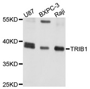 TRIB1 Antibody - Western blot analysis of extracts of various cell lines, using TRIB1 antibody at 1:1000 dilution. The secondary antibody used was an HRP Goat Anti-Rabbit IgG (H+L) at 1:10000 dilution. Lysates were loaded 25ug per lane and 3% nonfat dry milk in TBST was used for blocking. An ECL Kit was used for detection and the exposure time was 5s.