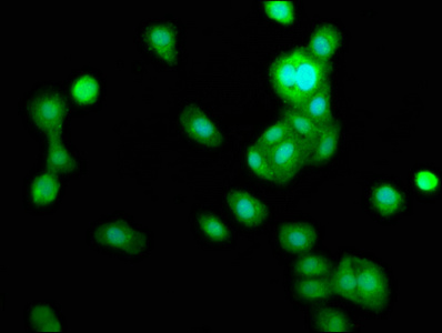 TRIB1 Antibody - Immunofluorescence staining of HepG2 cells at a dilution of 1:166, counter-stained with DAPI. The cells were fixed in 4% formaldehyde, permeabilized using 0.2% Triton X-100 and blocked in 10% normal Goat Serum. The cells were then incubated with the antibody overnight at 4 °C.The secondary antibody was Alexa Fluor 488-congugated AffiniPure Goat Anti-Rabbit IgG (H+L) .