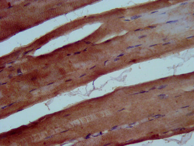 TRIB1 Antibody - IHC image of TRIB1 Antibody diluted at 1:500 and staining in paraffin-embedded human skeletal muscle tissue performed on a Leica BondTM system. After dewaxing and hydration, antigen retrieval was mediated by high pressure in a citrate buffer (pH 6.0). Section was blocked with 10% normal goat serum 30min at RT. Then primary antibody (1% BSA) was incubated at 4°C overnight. The primary is detected by a biotinylated secondary antibody and visualized using an HRP conjugated SP system.