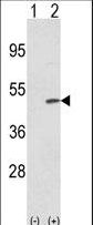 TRIB2 Antibody - Western blot of TRIB2 (arrow) using rabbit polyclonal TRIB2 N-term. 293 cell lysates (2 ug/lane) either nontransfected (Lane 1) or transiently transfected with the TRIB2 gene (Lane 2).