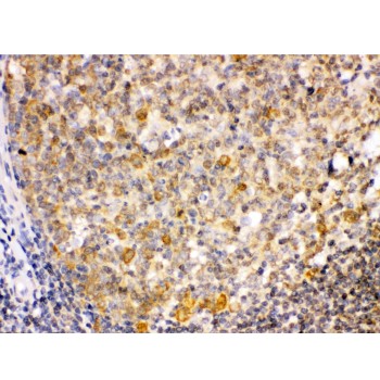 TRIB2 Antibody - TRIB2 was detected in paraffin-embedded sections of human tonsil tissues using rabbit anti- TRIB2 Antigen Affinity purified polyclonal antibody at 1 ug/mL. The immunohistochemical section was developed using SABC method.