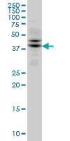 TRIB2 Antibody - TRIB2 monoclonal antibody (M04), clone 1B1 Western blot of TRIB2 expression in Jurkat.