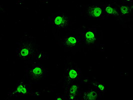 TRIB2 Antibody - Immunofluorescent staining of COS7 cells using anti-TRIB2 mouse monoclonal antibody.
