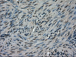 TRIB2 Antibody - IHC of paraffin-embedded endometrium tissue using anti-TRIB2 mouse monoclonal antibody. (Dilution 1:50).