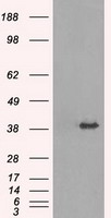 TRIB2 Antibody - HEK293T cells were transfected with the pCMV6-ENTRY control (Left lane) or pCMV6-ENTRY TRIB2 (Right lane) cDNA for 48 hrs and lysed. Equivalent amounts of cell lysates (5 ug per lane) were separated by SDS-PAGE and immunoblotted with anti-TRIB2.