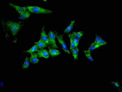 TRIB2 Antibody - Immunofluorescent analysis of Hela cells at a dilution of 1:100 and Alexa Fluor 488-congugated AffiniPure Goat Anti-Rabbit IgG(H+L)