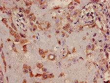 TRIB2 Antibody - Immunohistochemistry image of paraffin-embedded human placenta tissue at a dilution of 1:100