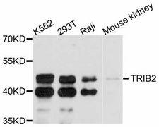 TRIB2 Antibody - Western blot analysis of extracts of various cell lines, using TRIB2 antibody at 1:3000 dilution. The secondary antibody used was an HRP Goat Anti-Rabbit IgG (H+L) at 1:10000 dilution. Lysates were loaded 25ug per lane and 3% nonfat dry milk in TBST was used for blocking. An ECL Kit was used for detection and the exposure time was 90s.