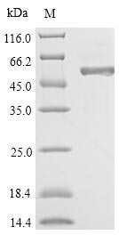 6GAL Protein - (Tris-Glycine gel) Discontinuous SDS-PAGE (reduced) with 5% enrichment gel and 15% separation gel.