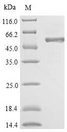 6GAL Protein - (Tris-Glycine gel) Discontinuous SDS-PAGE (reduced) with 5% enrichment gel and 15% separation gel.