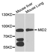 TRIM1 / MID2 Antibody - Western blot analysis of extract of various cells.