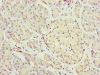 TRIM1 / MID2 Antibody - Immunohistochemistry of paraffin-embedded human pancreatic tissue at dilution of 1:100