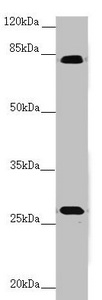 TRIM1 / MID2 Antibody - Western blot All Lanes:MID2 antibody at 3.32 ug/ml+ Mouse small intestine tissue Secondary Goat polyclonal to rabbit IgG at 1/10000 dilution Predicted band size: 84,80 kDa Observed band size: 83,30 kDa