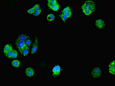 TRIM1 / MID2 Antibody - Immunofluorescent analysis of MCF-7 cells diluted at 1:100 and Alexa Fluor 488-congugated AffiniPure Goat Anti-Rabbit IgG(H+L)