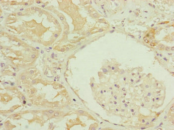 TRIM1 / MID2 Antibody - Immunohistochemistry of paraffin-embedded human kidney tissue at dilution of 1:100