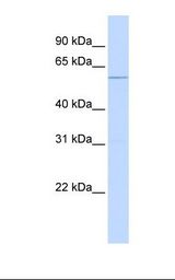 TRIM10 Antibody - Hela cell lysate. Antibody concentration: 1.0 ug/ml. Gel concentration: 12%.  This image was taken for the unconjugated form of this product. Other forms have not been tested.