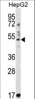 TRIM11 Antibody - TRIM11 Antibody western blot of HepG2 cell line lysates (35 ug/lane). The TRIM11 antibody detected the TRIM11 protein (arrow).