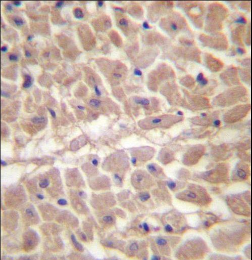 TRIM11 Antibody - TRIM11 Antibody immunohistochemistry of formalin-fixed and paraffin-embedded human heart tissue followed by peroxidase-conjugated secondary antibody and DAB staining.