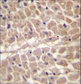 TRIM11 Antibody - TRIM11 Antibody immunohistochemistry of formalin-fixed and paraffin-embedded human heart tissue followed by peroxidase-conjugated secondary antibody and DAB staining.