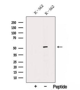 TRIM11 Antibody - Western blot analysis of extracts of K562 cells using TRIM11 antibody. The lane on the left was treated with blocking peptide.