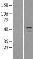 TRIM11 Protein - Western validation with an anti-DDK antibody * L: Control HEK293 lysate R: Over-expression lysate