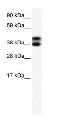 TRIM13 Antibody - Fetal Lung Lysate.  This image was taken for the unconjugated form of this product. Other forms have not been tested.
