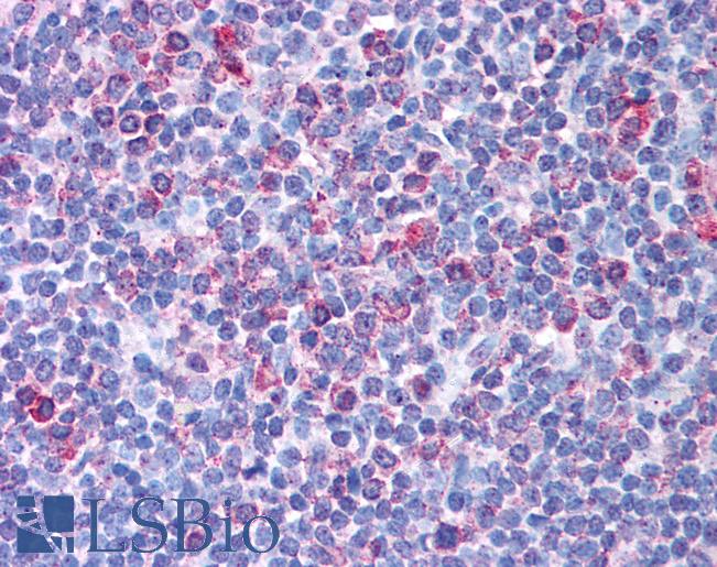 TRIM13 Antibody - Anti-RFP2 antibody IHC of human tonsil. Immunohistochemistry of formalin-fixed, paraffin-embedded tissue after heat-induced antigen retrieval. Antibody concentration 5 ug/ml.  This image was taken for the unconjugated form of this product. Other forms have not been tested.