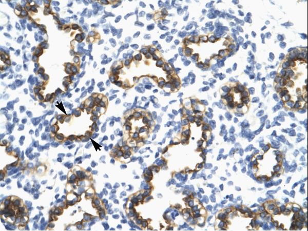 TRIM13 Antibody - Human Lung.  This image was taken for the unconjugated form of this product. Other forms have not been tested.