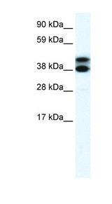 TRIM13 Antibody - TRIM13 / RFP2 antibody Western blot of Fetal lung lysate. This image was taken for the unconjugated form of this product. Other forms have not been tested.