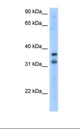 TRIM13 Antibody - Transfected 293T cell lysate. Antibody concentration: 2.5 ug/ml. Gel concentration: 12%.  This image was taken for the unconjugated form of this product. Other forms have not been tested.