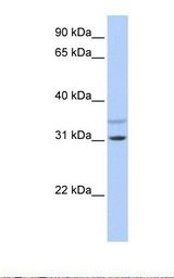 TRIM13 Antibody - 721_B cell lysate. Antibody concentration: 1.0 ug/ml. Gel concentration: 12%.  This image was taken for the unconjugated form of this product. Other forms have not been tested.