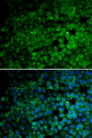 TRIM13 Antibody - Immunofluorescence analysis of HeLa cell using TRIM13 antibody. Blue: DAPI for nuclear staining.