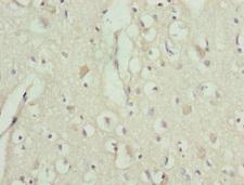 TRIM13 Antibody - Immunohistochemistry of paraffin-embedded human brain tissue at dilution 1:100