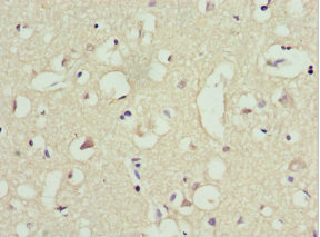 TRIM13 Antibody - Immunohistochemistry of paraffin-embedded human brain tissue at dilution 1:100