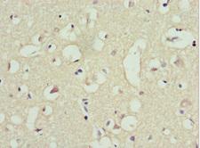 TRIM13 Antibody - Immunohistochemistry of paraffin-embedded human brain tissue at dilution 1:100