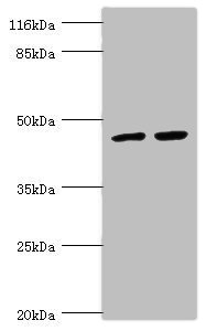 TRIM13 Antibody - Western blot All Lanes:TRIM13 antibody at 1.44ug/ml Lane 1:293T whole cell lysate Lane 2:Hela whole cell lysate Secondary Goat polyclonal to rabbit at 1/10000 dilution Predicted band size: 47,20,48 kDa Observed band size: 47 kDa