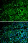 TRIM13 Antibody - Immunofluorescence analysis of HeLa cells using TRIM13 Polyclonal Antibody.