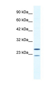 TRIM14 Antibody - TRIM14 antibody Western blot of Jurkat lysate. This image was taken for the unconjugated form of this product. Other forms have not been tested.