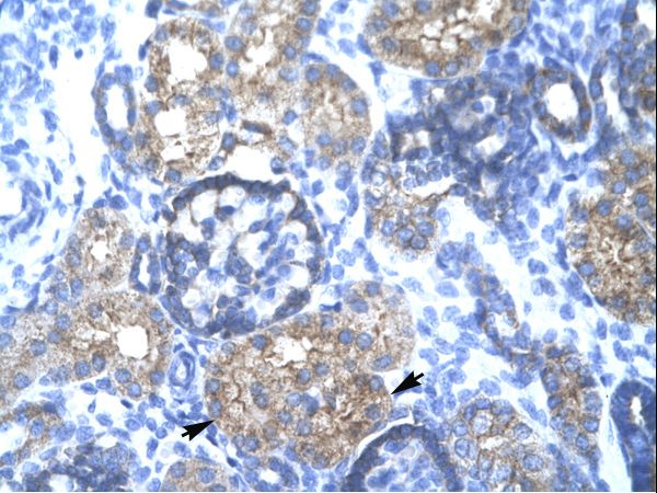 TRIM15 Antibody - TRIM15 antibody ARP34645_T100-NP_150232-TRIM15 (tripartite motif-containing 15) Antibody was used in IHC to stain formalin-fixed, paraffin-embedded human kidney.  This image was taken for the unconjugated form of this product. Other forms have not been tested.