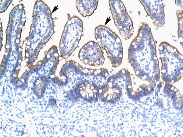 TRIM15 Antibody - TRIM15 antibody ARP34645_T100-NP_150232-TRIM15 (tripartite motif-containing 15) Antibody was used in IHC to stain formalin-fixed, paraffin-embedded human intestine.  This image was taken for the unconjugated form of this product. Other forms have not been tested.