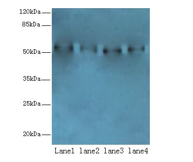 TRIM15 Antibody - Western blot. All lanes: TRIM15 antibody at 2 ug/ml. Lane 1: Jurkat whole cell lysate. Lane 2: HeLa whole cell lysate. Lane 3: HepG-2 whole cell lysate. Lane 4: A549 whole cell lysate. Secondary antibody: Goat polyclonal to Rabbit IgG at 1:10000 dilution. Predicted band size: 52 kDa. Observed band size: 52 kDa.