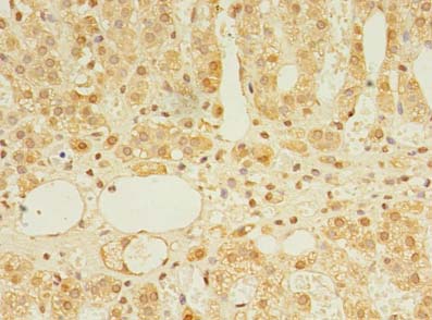 TRIM15 Antibody - Immunohistochemistry of paraffin-embedded human adrenal gland tissue using antibody at dilution of 1:100.