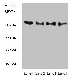TRIM15 Antibody - Western blot All lanes: TRIM15 antibody at 2µg/ml Lane 1: Jurkat whole cell lysate Lane 2: Hela whole cell lysate Lane 3: HepG2 whole cell lysate Lane 4: A549 whole cell lysate Secondary Goat polyclonal to rabbit IgG at 1/10000 dilution Predicted band size: 53, 13 kDa Observed band size: 53 kDa