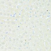 TRIM15 Antibody - Immunohistochemistry of paraffin-embedded rat liver using TRIM15 antibody at dilution of 1:100 (40x lens).