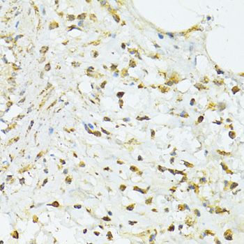 TRIM15 Antibody - Immunohistochemistry of paraffin-embedded human vermiform appendix using TRIM15 antibody at dilution of 1:100 (40x lens).