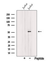 TRIM15 Antibody - Western blot analysis of extracts of Jurkat cells using TRIM15 antibody. The lane on the left was treated with blocking peptide.