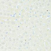 TRIM15 Antibody - Immunohistochemistry of paraffin-embedded Rat liver using TRIM15 Polyclonal Antibody at dilution of 1:100 (40x lens).